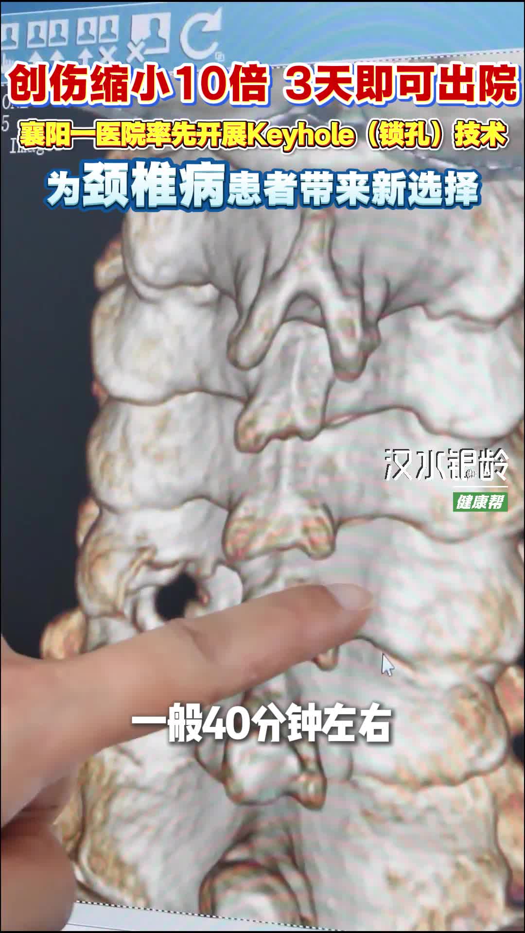 新质医疗服务力之一丨Keyhole技术，为颈椎病患者带来新选择！