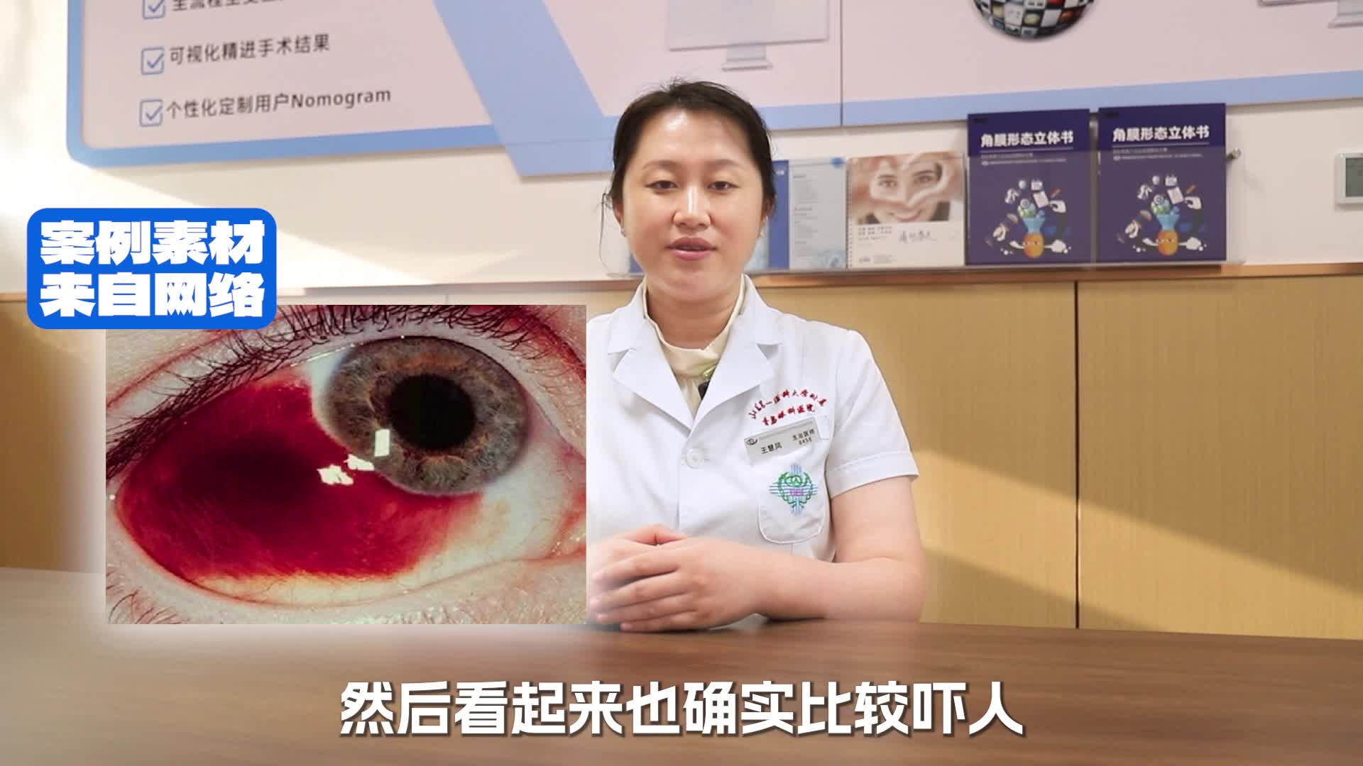 近视手术后结膜出血是正常情况吗？