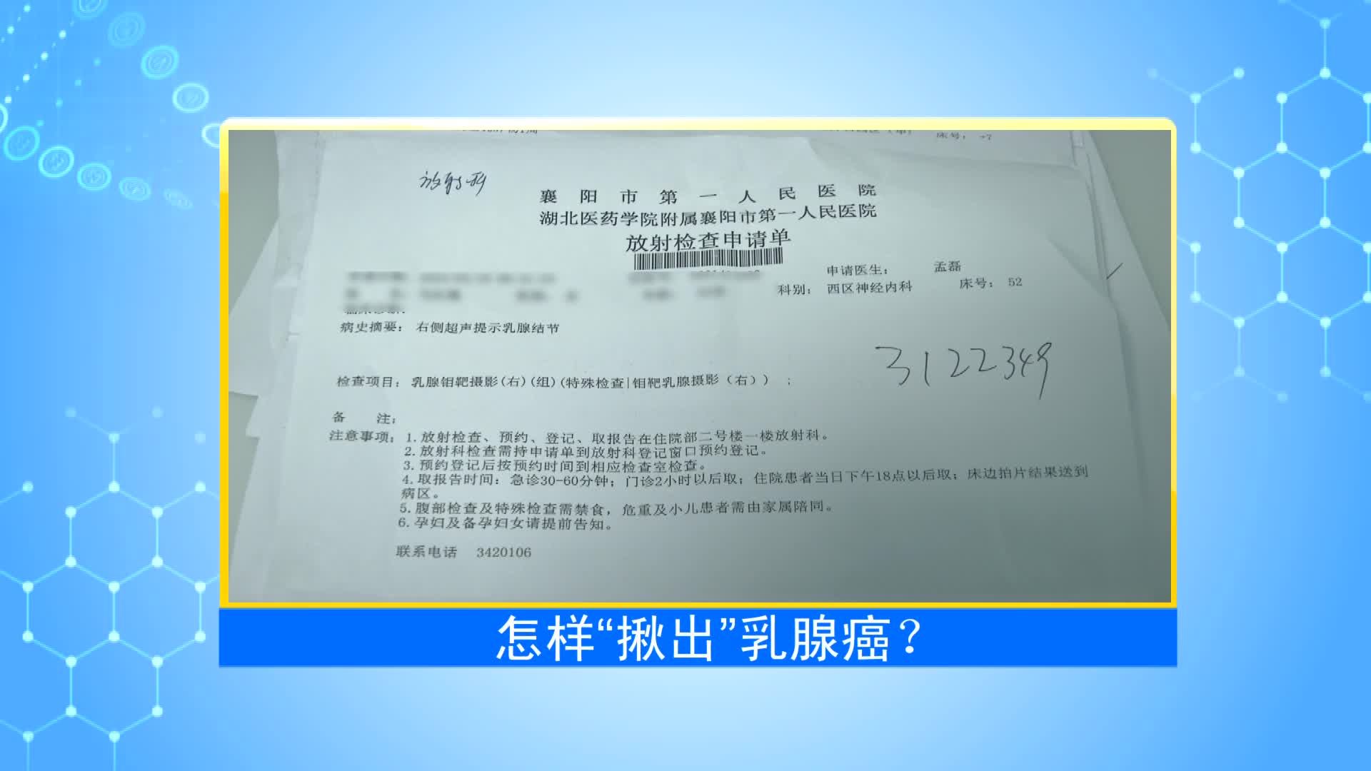 《第1健康》第96期：影像“扫描”“揪出”乳癌