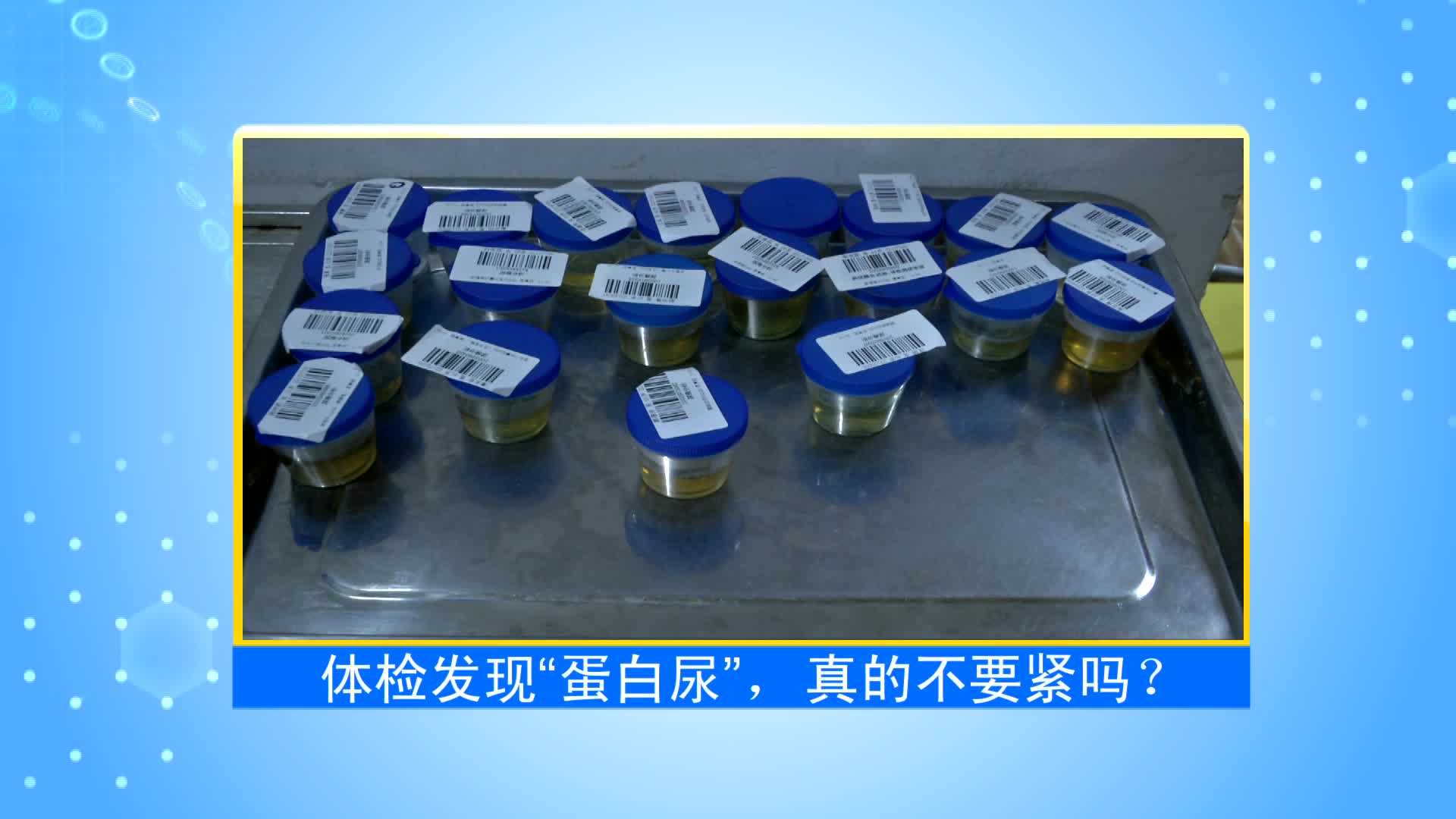 《第1健康》第41期：“蛋白尿”——肾脏病的风向标