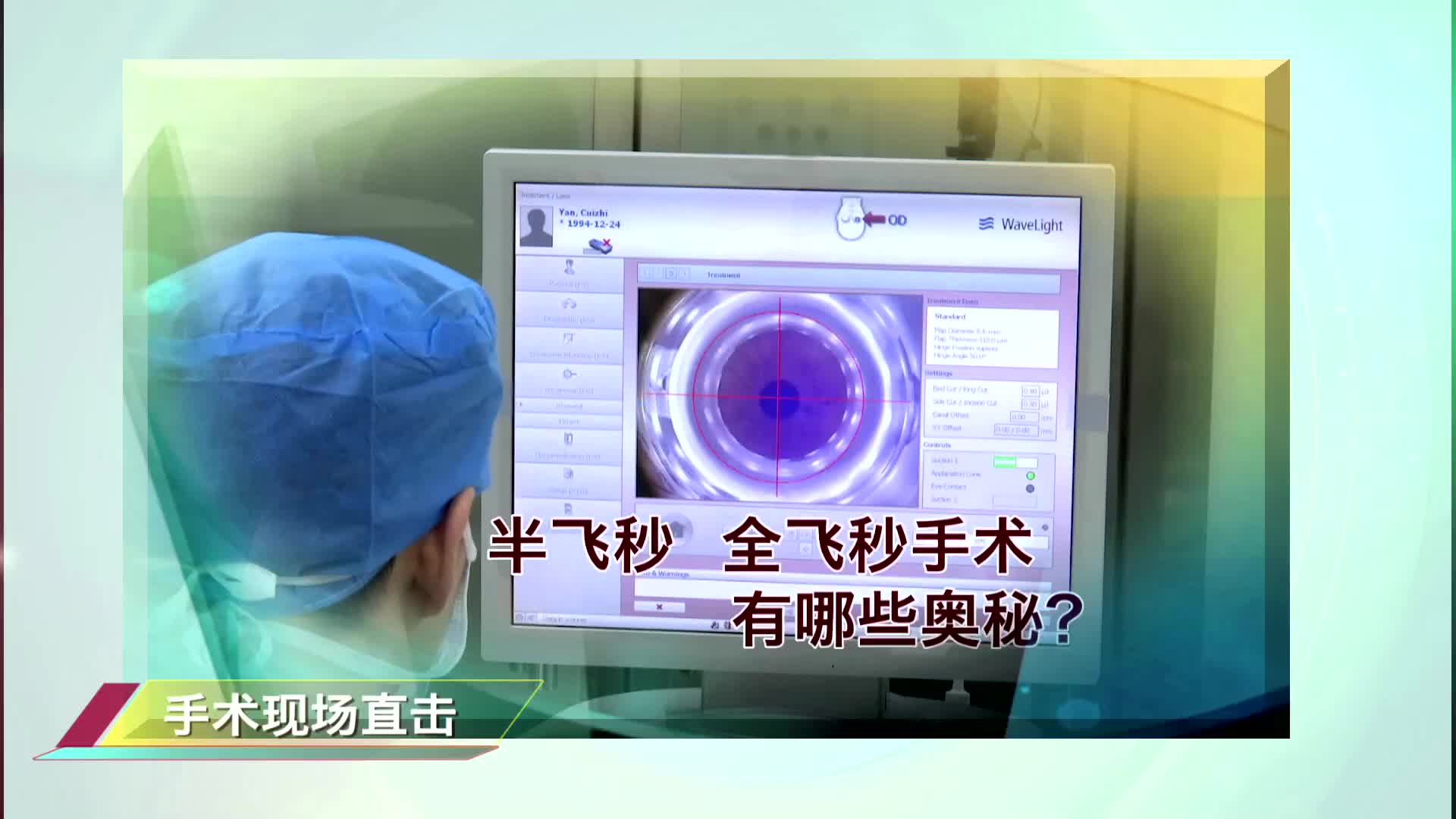 激光近视矫正手术
