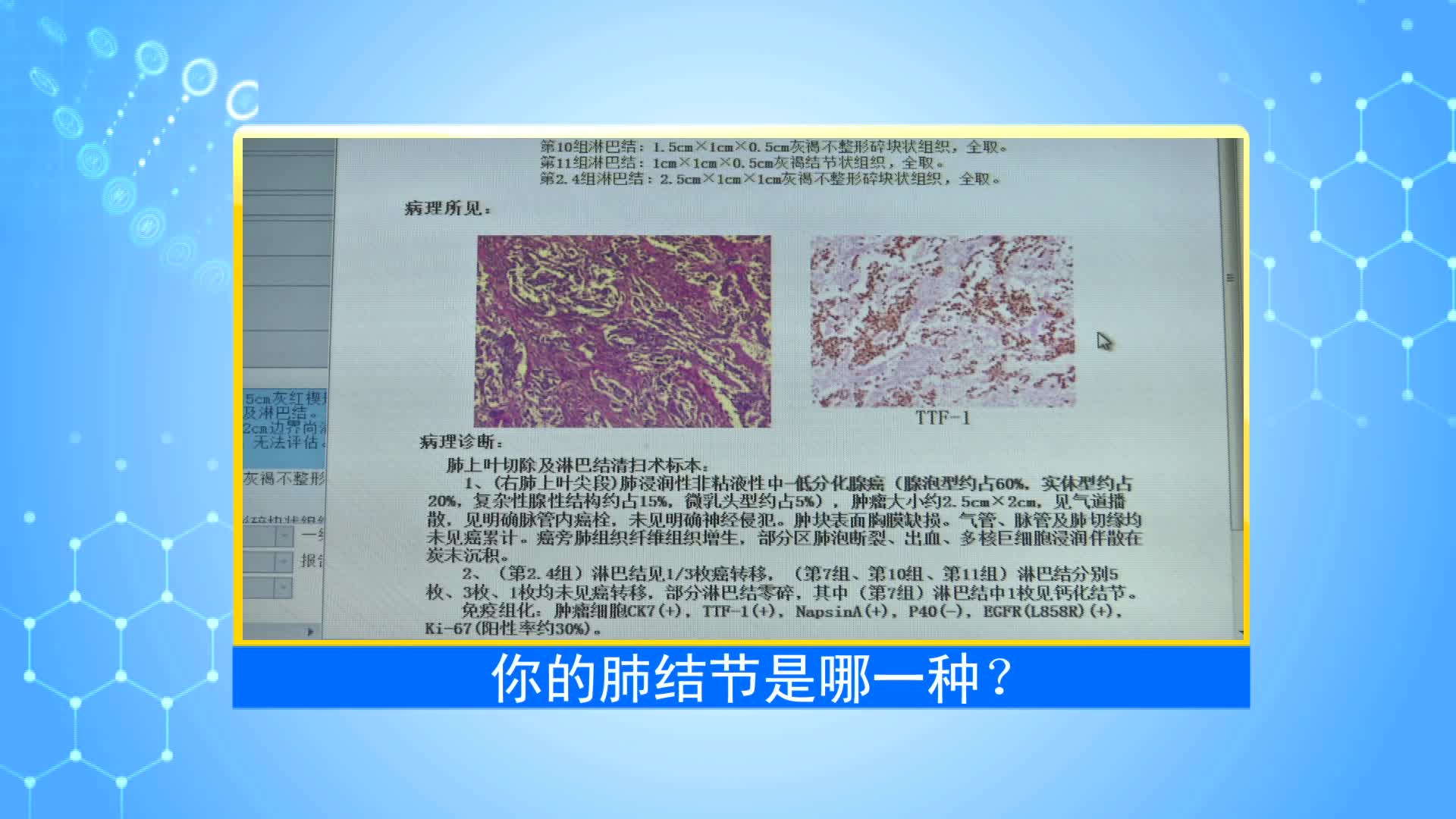 《第1健康》第99期：他们被称为“医生的医生”，可以拿出“金标准”