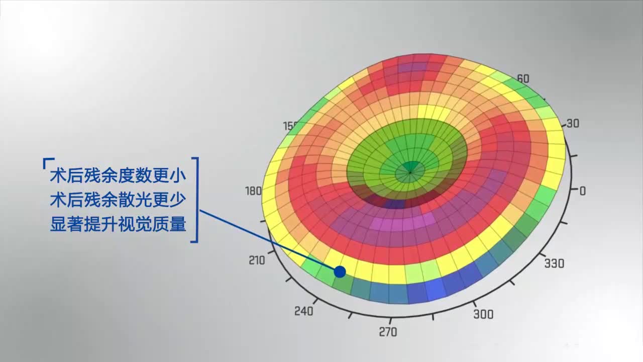 个性化精雕绿飞秒手术