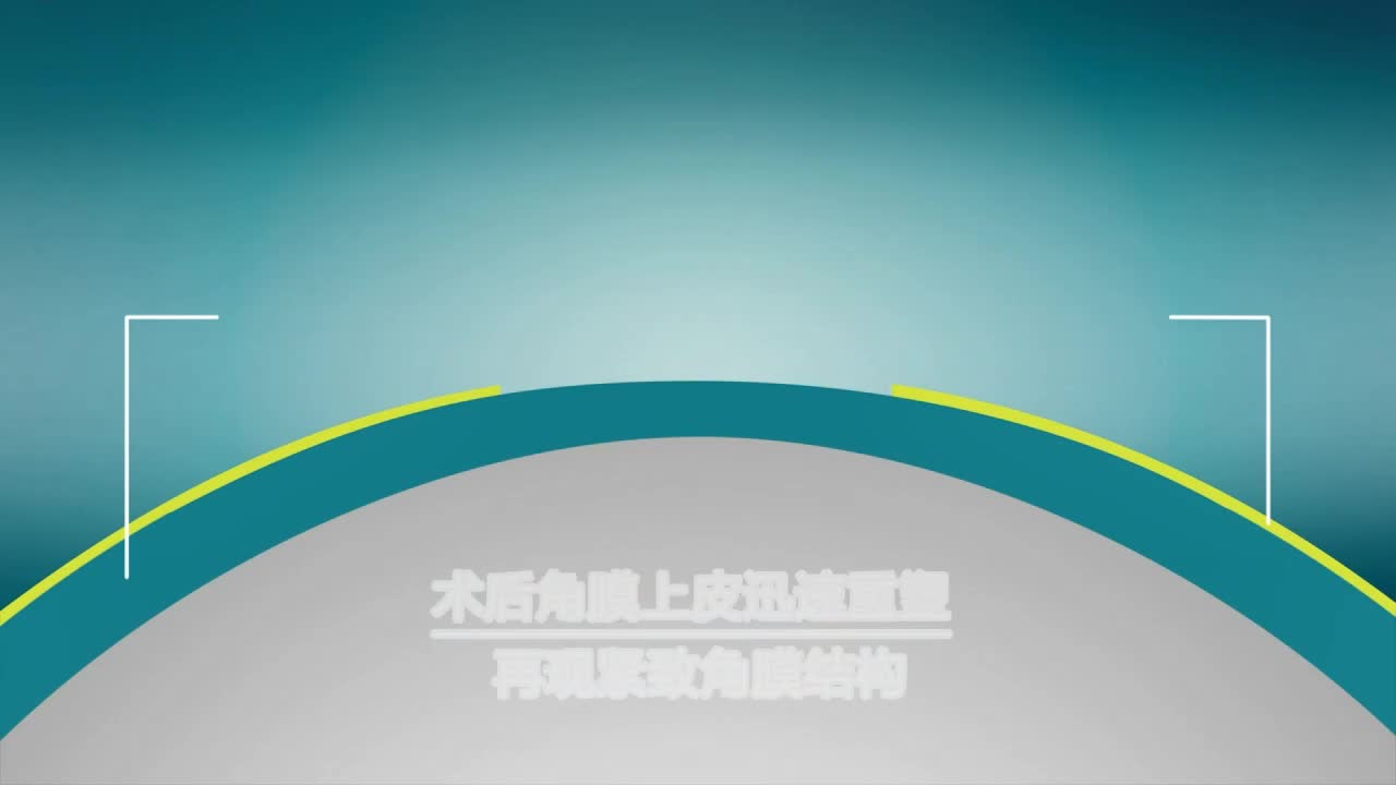 Smart全激光无切口手术