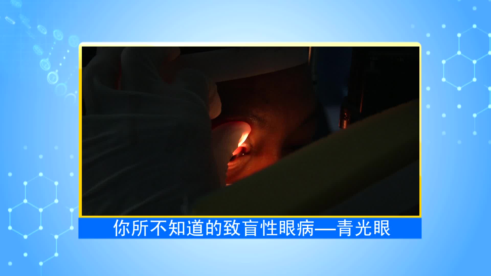 《第1健康》第43期：警惕“视力的小偷”——青光眼