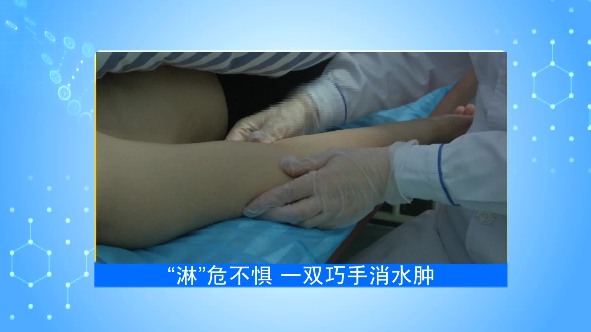《第1健康》第91期：“淋”危不惧 “肿”有办法