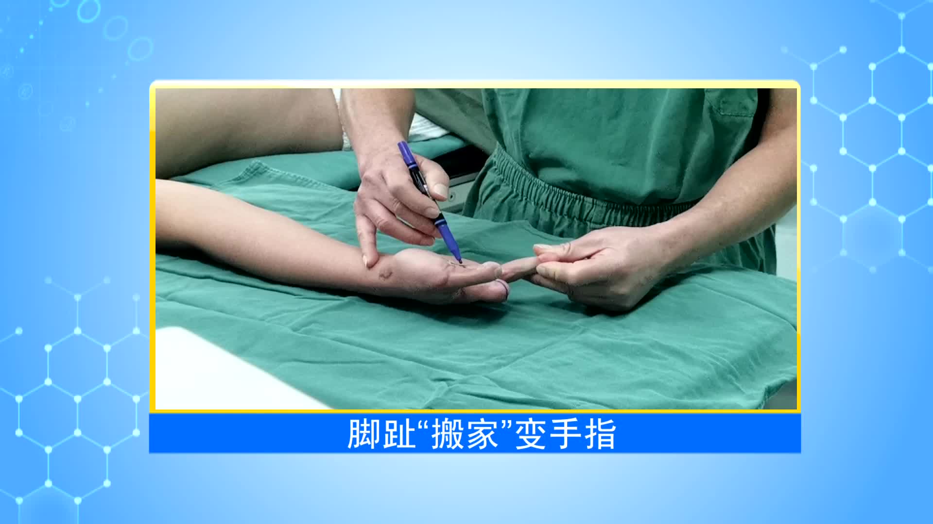 《第1健康》第54期：整形外科：修残补缺，重塑新生