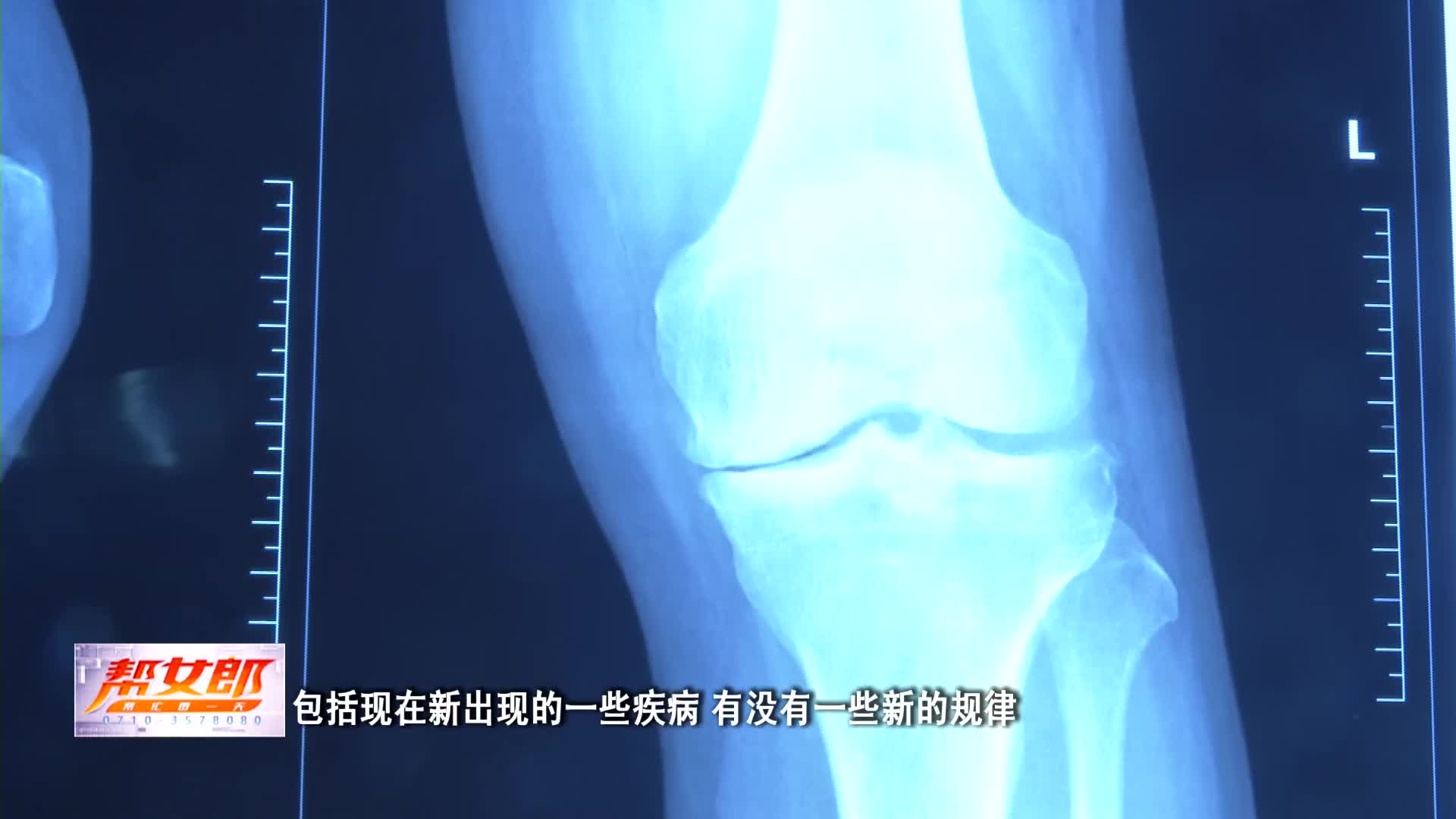 【帮女郎】勇攀医学高峰 成就璀璨未来